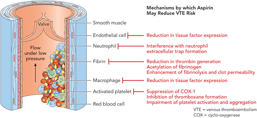 Composition of venous thrombosis and the antithrombotic effects of aspirin. Venous thrombosis typically originates in areas of slower blood flow, such as the venous anatomy near valves. Venous clots consist primarily of fibrin, red blood cells, and leukocytes. Platelets are involved, but are less prominent in comparison with the platelet-rich arterial thrombus. Aspirin exerts various antithrombotic effects on the participating cells and proteins of thrombus formation, and fibrinolysis via cyclooxygenase (COX) and COX-independent pathways. Professional illustration by Patrick Lane, ScEYEnce Studios.