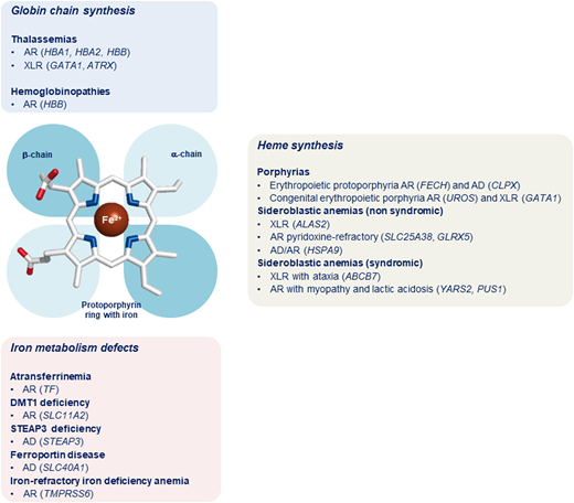 Classification of microcytic anemias. In the middle of the figure is a schematic representation of the prosthetic group of hemoglobin with a protoporphyrin ring (with iron) and the globin chains. In the top panel (light blue) is the classification of microcytic anemias caused by alterations of globin chain synthesis. In the right panel (gray) is the classification of microcytic anemias caused by impairment of heme synthesis. In the bottom panel (pink) is the classification of microcytic anemias caused by iron metabolism defects. AD, autosomal dominant inheritance; AR, autosomal recessive inheritance; XLR, X-linked recessive inheritance.