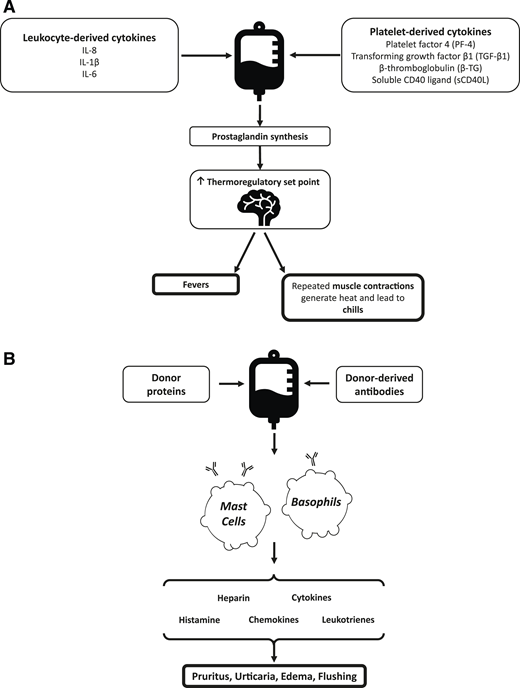 Pathophysiology of FNHTRs (A) and allergic reactions (B) in platelet transfusions. IL, interleukin.