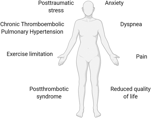 Long-term complications of recurrent VTE. Nonfatal, life-altering complications of VTE include postthrombotic syndrome (after DVT), chronic thromboembolic pulmonary hypertension (after PE), exercise intolerance, posttraumatic stress, dyspnea, anxiety, functional/exercise limitation, pain, reduced quality of life, and health care costs.2,40 These symptoms may have a major impact on functional outcome.40