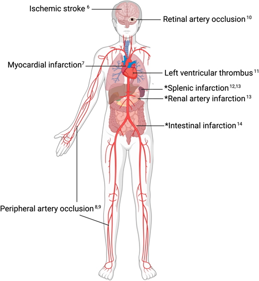 Anatomic sites of unexplained acute arterial thrombosis with citations for relevant comprehensive reviews.6-14 *Organ infarctions can occur due to arterial thrombosis but also venous thrombosis, low flow states, and other causes. “Defining the clot” (ie, determining if the end-organ infarction is caused by arterial thrombosis) is a first step in determining further workup and best management.