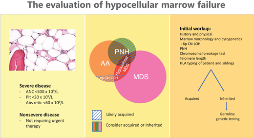 The evaluation of hypocellular marrow failure.
