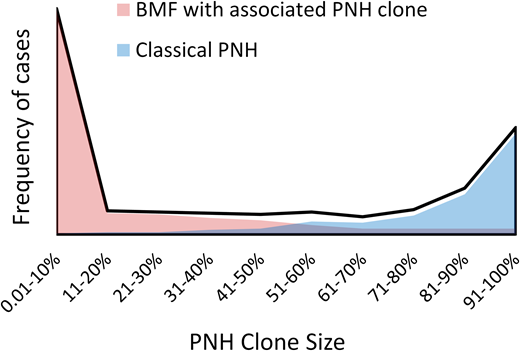 The bimodal distribution of PNH clone sizes closely correlates with the patients' clinical presentations. The stylized schematic depicts the bimodal distribution of granulocyte PNH clone sizes (black line) based on published PNH clone size distributions.12,14 Red and blue area plots illustrate the different clinical presentations that correlate with the extremes of PNH clone sizes. Patients with bone marrow failure who have an associated PNH clone are shown in red. Classical PNH presentations are shown in blue.