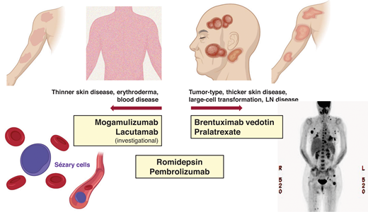 Examples of newer systemic agents and their clinical activity in different patient profiles.
