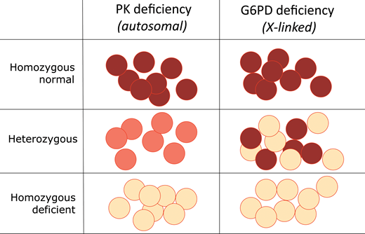 Different phenotypes of heterozygotes for red blood cell enzymopathies. In a heterozygote for PK deficiency, encoded by an autosomal gene (Table 1), the level of enzyme is about one-half of normal in all red blood cells. Since this level of enzyme is sufficient, there are no clinical consequences—ie, PK deficiency is recessive. In a heterozygote for deficiency of G6PD, encoded by an X-linked gene, the situation is quite different: X chromosome inactivation generates red blood cell mosaicism, whereby some red blood cells are entirely normal, and others are G6PD deficient. Therefore, G6PD deficiency is expressed in heterozygotes: it is not recessive.