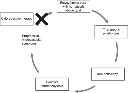 Vicious cycle: iron deficiency, polycythemia vera, and thrombocytosis.