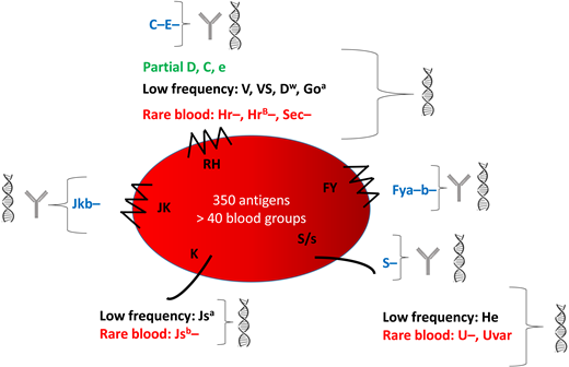 Characteristics of the main blood groups in SCD patients and their identification. This figure shows the 5 blood group systems most frequently involved in alloimmunization. The following are shown for each blood group: blue, the common antigens rarely expressed; green, the partial antigens; black, the low-frequency antigens most frequently expressed; red, the high-frequency antigens most frequently absent (rare blood groups). They can be identified by serology and genotyping or genotyping alone.