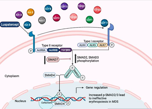 TGF-β pathways in MDS: Various ligands belonging to the TGF-β pathway bind to activin-like kinase (ALK) receptors and activate SMAD proteins. SMAD proteins act as transcription factors and regulate important hematopoietic genes that are altered in MDS. ActRIIA, activin receptor type IIA; ActRIIB, ActRIIB.