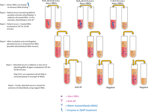 Adsorption procedure to remove WAA using allogeneic RBCs. Example of the multistep process for allogeneic adsorptions to remove WAA to identify whether an underlying alloantibody is present (eg, anti-Jka). Three donor RBCs of known phenotypes (ie, R1R1, R2R2, and rr) are selected and treated with enzyme or ZZAP. The patient's serum (or plasma) is added to an aliquot of each of the 3 donor RBCs and incubated for 10 to 60 minutes at 37 °C. Three separate adsorptions are performed, each undergoing 1 to 4 rounds of adsorption in which the patient's serum is repeatedly incubated with a new set of donor RBCs. Following an adequate number of adsorptions, adsorbed serum samples are tested against reagent RBCs. If 1 or more aliquots are positive, an alloantibody can be identified based on the pattern of reactivity and knowledge of the antigens expressed on each aliquot of donor RBCs used for adsorption.