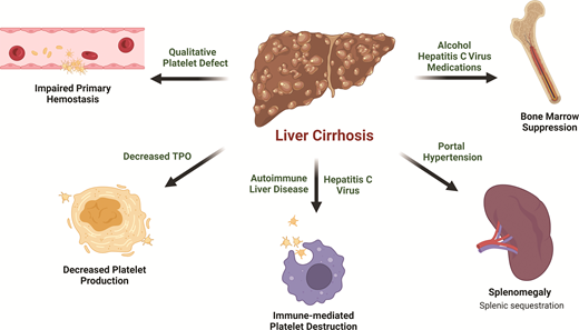Quantitative and qualitative platelet defects in liver disease.