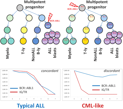 Schematic illustration of key differences between “typical ALL” and “CML-like” disease. Adapted from Zuna et al. with permission.23