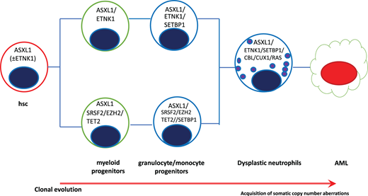 Clonal hierarchy in aCML showing the progressive acquisition of somatic mutations. AML, acute myeloid leukemia.