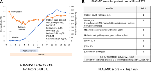 Clinical case 3: thrombotic thrombocytopenic purpura (TTP). (A) Patient presented with severe and selective thrombocytopenia (blue). Platelets did not improve after intravenous immunoglobulin (IVIG) treatment for presumptive immune thrombocytopenia (ITP). Patient developed a progressive decrease in hemoglobin (orange), and markers of hemolysis consistent with a microangiopathic anemia. Platelet count normalized with plasmapheresis and steroids. INR, international normalized ratio; LDH, lactate dehydrogenase; MCV, mean corpuscular hemoglobin; WBC, white blood cells. (B) PLASMIC score was high, compatible with TTP.