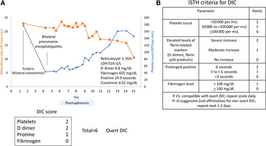 Clinical case 3: disseminated intravascular coagulation (DIC). (A) Patient with pneumonia develops a rapid drop in platelet count (blue) and increased white count (orange) with microangiopathic hemolytic anemia and high D dimer. Thrombotic thrombocytopenic purpura (TTP) was considered given neurologic symptoms, and plasmapheresis was initiated. The patient recovered with antibiotic treatment for pneumonia and sepsis. (B) International Society on Thrombosis and Haemostasis (ISTH) disseminated intravascular coagulation (DIC) score high, compatible with overt DIC.