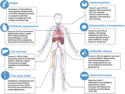 Signs, symptoms, and complications of PK deficiency.