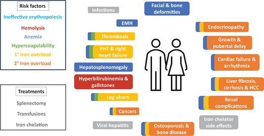 Multisystem complications from risk factors and treatments of thalassemia. Risk factors and their corresponding complications are color-coded. Complications with overlapping colors denote those stemming from and exacerbated by the multiple risk factors involved. Modified from Taher AT, Musallam KM, Cappellini MD. β-Thalassemias. N Engl J Med. 2021;384(8):727-743. 1°, primary; 2°, secondary; EMH, extramedullary hematopoiesis; HCC, hepatocellular carcinoma; PHT, pulmonary hypertension.