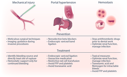 Categories of bleeding in liver disease. Bleeding in patients with liver disease may be due to mechanical injury (by inadvertent laceration of a vessel during surgery or a minor invasive procedure), portal hypertension-related causes (eg, variceal bleeding), or hemostatic failure (bleeding following dental extraction, bruising, and bleeding from puncture wounds). Shown are strategies to prevent and treat these different types of bleeding complications. Reprinted from Lisman with permission.47 FFP, fresh frozen plasma.