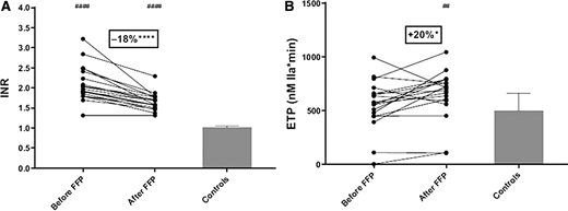 Therapeutic doses of fresh frozen plasma (FFP) on international normalized ratio (INR) and endogenous thrombin potential (ETP). (A) INR and (B) ETP measured in the presence of thrombomodulin in 19 patients with chronic liver disease and a prolonged INR before and after FFP administration, compared with controls (n = 20). Bars represent median ± interquartile ranges. *P < .05. ****P < .0001, before vs after FFP transfusion. ##P < .01, patients vs controls. ####P < .0001, patients vs controls. Adapted from with permission from Elsevier Inc.28