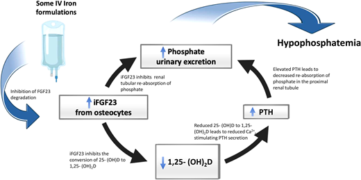Mechanism of treatment-emergent hypophosphatemia. Following the administration of some intravenous iron formulations is a sharp rise in the plasma iFGF23, triggering a pathophysiological cascade of renal phosphate wasting, calcitriol deficiency, and secondary hyperparathyroidism. This frequently culminates in hypophosphatemia even after iFGF23 levels have normalized. PTH, parathyroid hormone.
