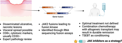 Primary cutaneous CD8+ aggressive epidermotropic cytotoxic T-cell lyphoma. Patients often present with disseminated eruptive lesions with ulceration. JAK2 fusions leading to kinase activity are considered hallmarks of disease. Created in BioRender. Stuver, R (2024). https://BioRender.com/p16n263.