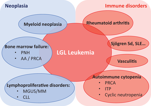 Spectrum of LGL leukemia and associated diseases. AA, aplastic anemia; CLL, chronic lymphocytic leukemia; ITP, immune thrombocytopenia; MGUS, monoclonal gammopathy of undetermined significance; MM, multiple myeloma; PNH, paroxysmal nocturnal hemoglobinuria; Sjögren Sd, Sjögren syndrome; SLE, systemic lupus erythematosus.