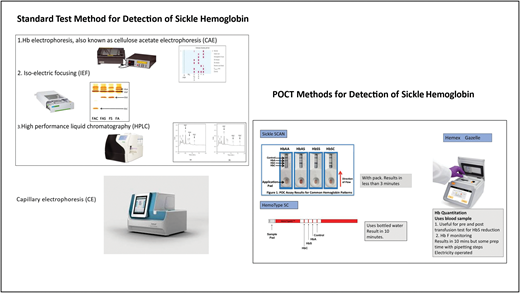 Standard and point-of-care methods for detection of sickle hemoglobin.