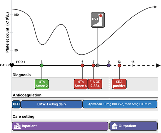 Clinical case time line. The case begins with CABG and chronicles major events thereafter. The platelet count over time, with a classic “biphasic” pattern, is illustrated above the time line. Events in the diagnostic process are highlighted in green when less consistent with HIT and in red when more concerning for HIT. Assay results are indicated on the day results are returned; both EIA and SRA were collected on POD 6. The anticoagulation use across time is presented, with each agent highlighted in a unique shade of blue. The length of the shade illustrates the duration of that anticoagulant along the time line. The care setting indicates when the patient was hospitalized and discharged relative to the time line. BID, twice daily; DVT, deep vein thrombosis; LMWH, low-molecular-weight heparin; m, month; UFH, unfractionated heparin.