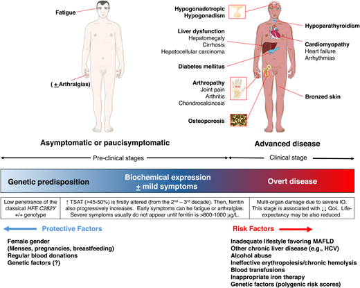 Clinical manifestations and cofactors influencing the penetrance of HFE-hemochromatosis. Most patients are now diagnosed in the early phase before the development of organ damage-related symptoms. Heart and endocrine manifestations are often the presenting symptoms in severe (juvenile) non-HFE hemochromatosis forms. They can also be seen in patients with severe HFE- hemochromatosis and substantial cofactors burden,34 but they are now exceedingly rare. HCV, hepatitis C virus; QoL, quality of life.
