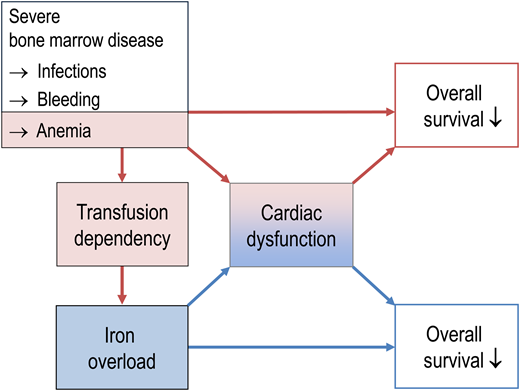 Relationship between bone marrow failure, iron overload, and prognosis in patients with MDS. In part, transfusion dependency predicts shortened survival because it reflects hematopoietic insufficiency and its complications like infection, bleeding, and the sequelae of chronic anemia. In addition, transfusion dependency causes iron overload, thereby creating a new medical problem that has its own negative impact on overall survival, partly via cardiac problems.