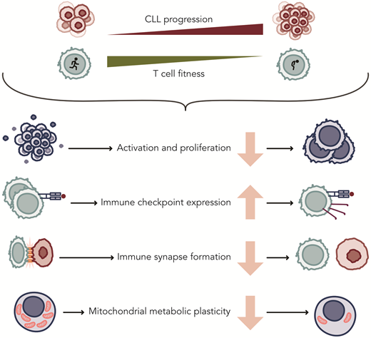Acquired changes in T cells of patients with CLL that affect their function. Professional ilustration by Somersault18:24.