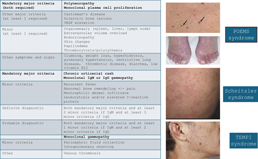Diagnostic criteria and cutaneous manifestations of select multi-organ MGCS syndromes. MGCS, monoclonal gammopathy of clinical significance, VEGF, vascular endothelial growth factor. Adapted from: Dispenzieri A. How I treat POEMS syndrome. Blood. 2012;119(24):5650-5658, Figure 2; Palladini G, Merlini G. The elusive pathogenesis of Schnitzler syndrome. Blood. 2018;131(9):944-946, Figure; Sykes DB, O'Connell C, Schroyens W. The TEMPI syndrome. Blood. 2020;135(15):1199-1203, Figure 1.