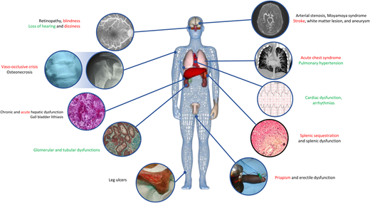 Acute (red) or chronic manifestations (black) or both (green).