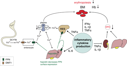 Mechanisms of ESA hyporesponsiveness. Overview of pathogenic mechanisms by which inflammatory cytokines suppress iron uptake and mobilization and erythropoiesis, thereby worsening anemia in patients with CKD. IL-6 stimulates liver production of hepcidin, which downregulates ferroportin (FPN) on all cells and thereby restricts iron availability resulting in functional iron deficiency. In the duodenum, DCYTB reduces ferric iron (Fe3+) to its ferrous form (Fe2+), which is then transported into the cytosol of enterocytes by DMT1. DCYTB and DMT1 are mostly HIF-2-regulated. Absorbed iron is released into the circulation by FPN, the only known cellular iron exporter, the expression of which is regulated by HIF-2 and hepcidin. FPN exports Fe2+, which is oxidized to Fe3+ by enterocyte hephaestin or, in the case of hepatocytes and RES cells, by plasma ceruloplasmin before transport in a complex with TF to the bone marrow and other organs. TF-Fe3+ complexes bind specific cell surface TF receptors and then enter cells via endocytosis of TF-receptors to which they are bound. TF is HIF-regulated, and hypoxia and HIF-PHIs increase TF plasma levels and total iron-binding capacity. Increased hepcidin synthesis in the liver due to inflammation results in decreased FPN cell surface expression, as hepcidin promotes FPN degradation and lowers its cell surface expression. As a result, less iron is released from enterocytes, hepatocytes, and RES cells. In CKD, plasma hepcidin levels are increased at baseline due to diminished renal clearance. Functional iron deficiency is exacerbated further by inflammation. Tumor necrosis factor α (TNF-α) decreases EPO synthesis in the kidney, further exacerbating relative EPO-deficiency in patients with CKD anemia, and, together with IL-1β and interferon γ (IFNγ), suppresses erythroid maturation and proliferation. Although not shown, TNF-α also increases hemophagocytosis of RBCs by macrophages, thereby decreasing RBC life span and exacerbating iron sequestration in RES cells. BM, bone marrow; DCYTB, duodenal cytochrome b; DMT1, divalent metal transporter 1; RES, reticuloendothelial system; TF, transferrin.