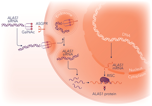 The mechanism of action of givosiran. Givosiran is an RNAi medication that inhibits ALAS1 in the liver. Givosiran is conjugated to N-acetylgalactosamine (GalNac), which mediates its targeting to hepatocytes. The ASGPR transmembrane receptors on hepatocytes have high affinity and specificity for GalNac. After binding to ASGPR receptors, givosiran is brought into endolysosomes, where the GalNac ligand is rapidly degraded. Givosiran's double-stranded ALAS1 small interfering RNA (ALAS1-siRNA) molecule is released into the cytosol, where it is cleaved by the enzyme dicer into slightly shorter double-stranded fragments of approximately 20 base pairs and separated into single-stranded RNAs, a passenger (sense) strand and guide (antisense) strand. The passenger strand is degraded, and the guide strand binds to cellular ALAS1-mRNA and is incorporated into the RNA-induced silencing complex (RISC). RISC then cleaves the new double-stranded RNA, resulting in a decrease in the amount of ALAS1 enzyme. Professional illustration by Somersault18:24.