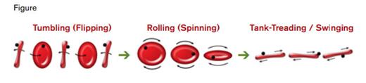 Three Rheologic States of Erythrocytes Depending Upon Increasing Shear Rate. Each state, tumbling (flipping), rolling (spinning), and tank-treading/swinging shows one erythrocyte with sequential changes in flow from left to right. In each rheologic state, the erythrocyte has a black dot representing an adherent microbead, as used experimentally to mark a location on the red cell membrane. At low shear rates on the left, the erythrocyte tumbles (flips) while maintaining membrane solidity so that the microbead remains in the same location relative to the rest of the cell. As the shear rate is increased (left green arrow), the orientation of the erythrocyte in the shear plane allows a wheel-like rolling, while the microbead remains in the same location because the membrane remains relatively solid. With further increases in shear rate, the rolling erythrocyte reorients itself by 90 degrees, so that it is spinning while maintaining membrane solidity. With even further increases in shear rate (right green arrow), the erythrocyte membrane fluidity reaches the point at which the membrane rotates around the cytoplasm (tank-treads), and the microbead moves relative to its former location on the erythrocyte. The tank-treading erythrocyte maintains its basic biconcave shape, but it has slight fluctuations in its orientation so that it “swings” relative to the shear plane.