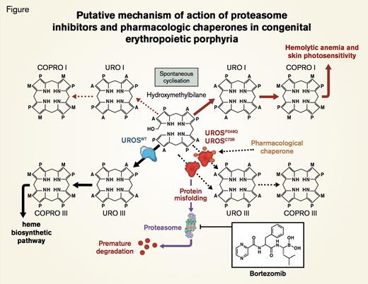 Putative Mechanism of Action of Proteasome Inhibitors and Pharmacologic Chaperones in Congenital Erythropoietic Porphyria. UROSC73R and UROSP248Q proteins are misfolded and subjected to premature degradation by the proteasome pathway, leading to deficiency of UROS enzymatic activity and accumulation of uroporphyrinogen I (URO I) and coproporphyrinogen I (COPRO I). Proteasome inhibitors such as bortezomib partially rescue UROSC73R and UROSP248Q expression and restore the metabolic heme biosynthetic pathway by preventing proteolysis. Conceivably, pharamacologic chaperone therapy could also be used to stabilize UROSP248Q and UROSC73R proteins and prevent premature degradation by the proteasome pathway.Blouin J et al. PNAS 2013;110:18238-18243 © 2013 by National Academy of Sciences
