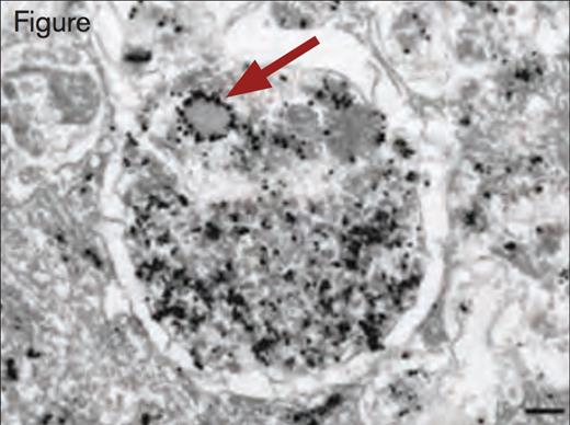 Immunogold Detection of vWF Protein in a Weibel–Palade Body Within an Autophagosome. Scale bar, 200 nm. Reprinted by permission from Macmillan Publishers Ltd: Nature Medicine. 2013; 19(10):1282, Copyright 2013.