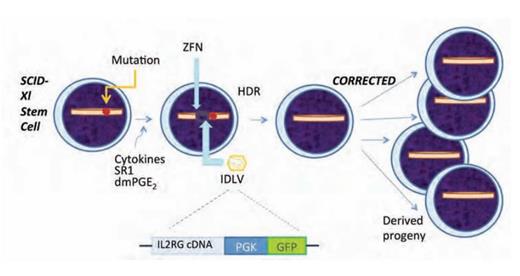 Correction of X-linked Severe Combined Immunodeficiency (SCID-X1) by Gene Editing. The illustration of the stem/progenitor cell on the far left depicts the location of the gene mutation that causes the disorder. The affected cells are incubated in a cytokine cocktail that induces cell cycling without differentiation. Next, the targeted zinc finger nuclease (ZFN) is introduced into the cell by electroporation, followed by transduction with integrase deficient lentiviral vector (IDLV). The IDLV contains the cDNA for IL2RG exons 5-8 and green fluorescent protein (GFP) driven by the phosphoglycerate kinase (PGK) promoter. GFP functions as an easily identifiable marker expressed in parallel with IL2RG. This process results in high-fidelity homology directed repair (HDR), and thereby, corrects the gene mutation that caused SCID-X1. The corrected stem cells can be used therapeutically as, following transplant, their hematopoietic progeny, including T cells and NK cells, will expand in vivo and thereby restore normal immune function (far right).