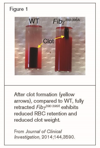 Vercellotti 1 11/12 2014. / Vercellotti 1 11/12 2014