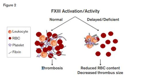 FXIII Activation/Activity. FXIII is a major determinant of thrombus size through its effects on red cell retention.Thanks to Maria Aleman and Alisa Wolberg, University of North Carolina for providing this figure.