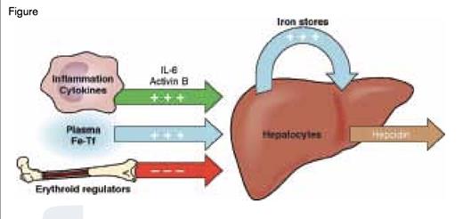 Regulation of Hepcidin Production by the Liver. Three major processes that influence hepcidin transcription are 1) induction by infection/inflammation (green), 2) induction by iron status (blue), or 3) suppression by expanded erythroid precursors (red). Modified slightly from Ganz T, Systemic Iron Homeostasis, Physiol Rev. 2013;93:1721-1741.