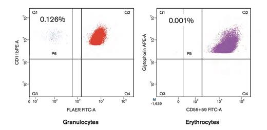 Detection of PNH-Type Cells Using High Sensitivity Flow Cytometry. Detection of paroxysmal nocturnal hemoglobinuria (PNH) -type cells using high-sensitivity flow cytometry. The patient possessed increased PNH-type cells only in granulocytes.