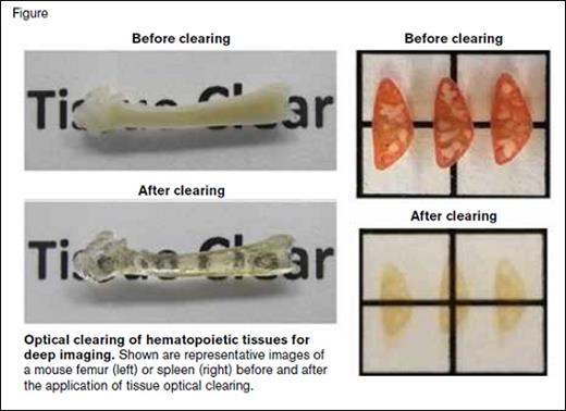 Optical Clearing of Hematopoietic Tissues for Deep Imaging. Shown are representative images of a mouse femur (left) or spleen (right) before and after the application of tissue optical clearing.