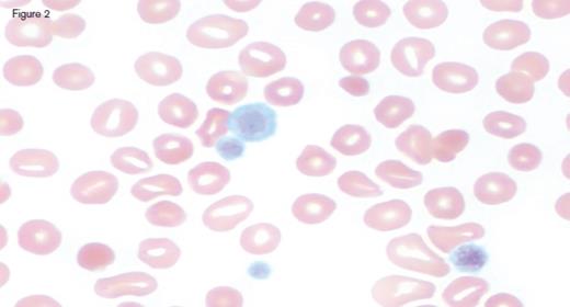 IC Dietrich 3/3/17 Fig 2. / IC Dietrich 3/3/17 Fig 2