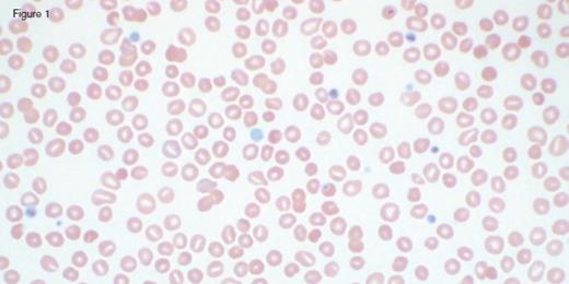 IC Dietrich 3/3/17. / IC Dietrich 3/3/17