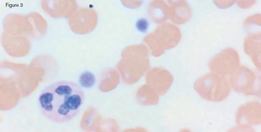 IC Dietrich 3/3/17 Fig 3. / IC Dietrich 3/3/17 Fig 3