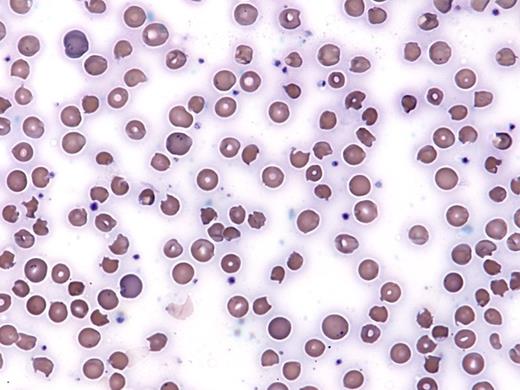 IC Hall 3/3/17. / IC Hall 3/3/17