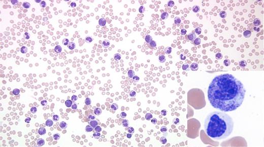 Image Challenge May June 2017. / Image Challenge May June 2017