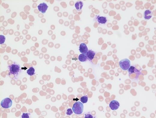 Giemsa-stained Peripheral Blood Smear (Low Power).