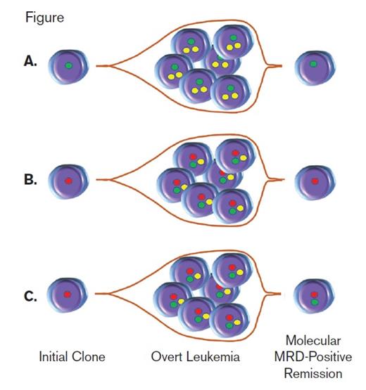 (A) Persistence of non-DTA mutations is associated with a higher risk of relapse. (B) Persistence of DTA-only mutations in remission is not associated with risk of relapse. (C) Persistence of DTA and non-DTA) mutations in remission is associated with a higher risk of relapse. MRD, minimal residual disease.